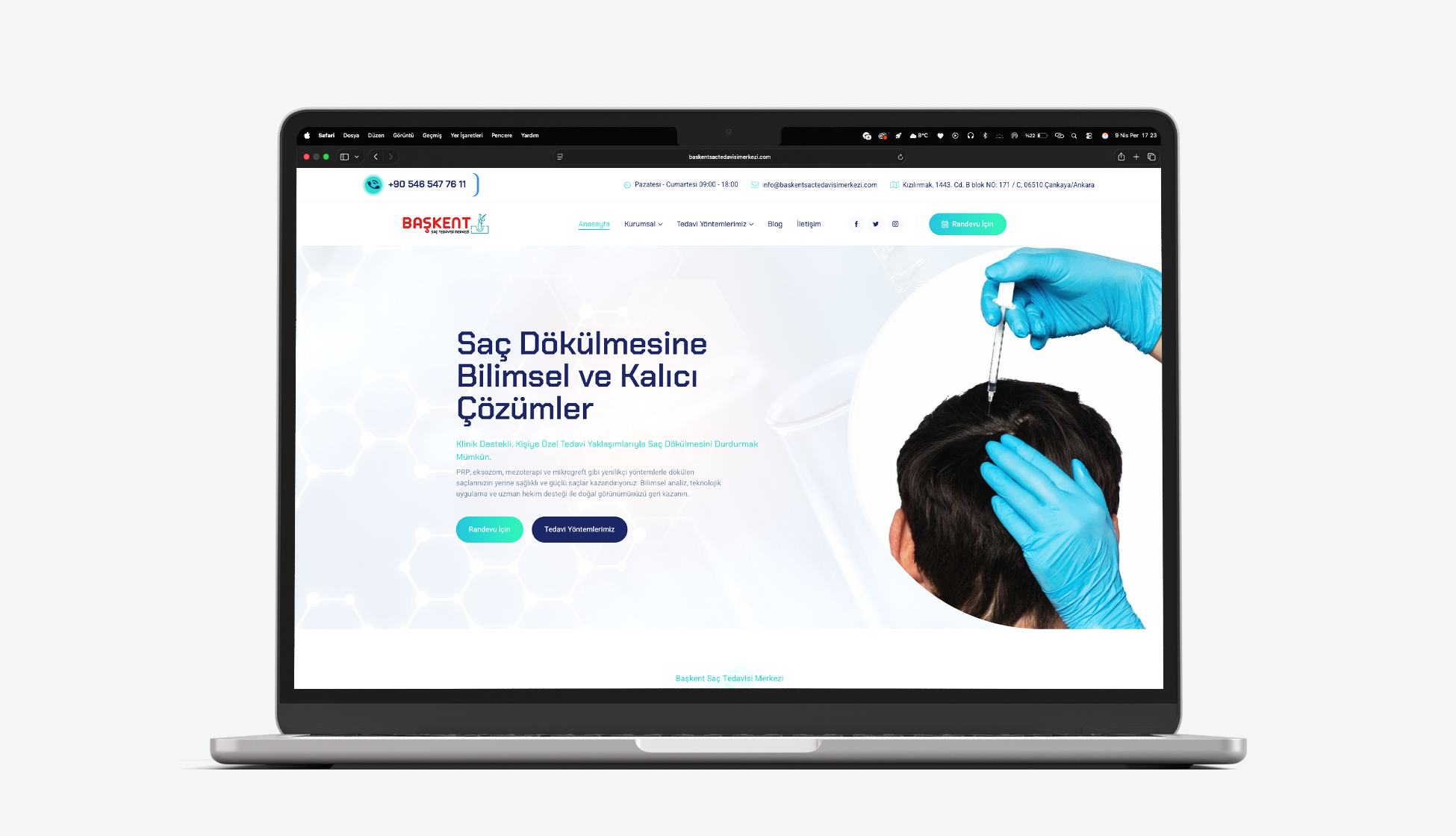 Başkent Saç Tedavisi Merkezi