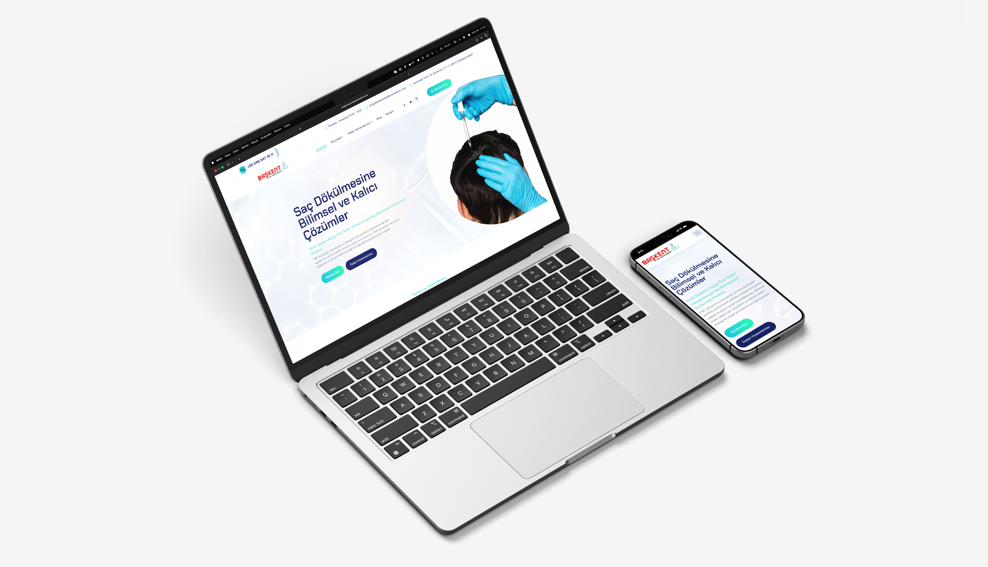 Başkent Saç Tedavisi Merkezi